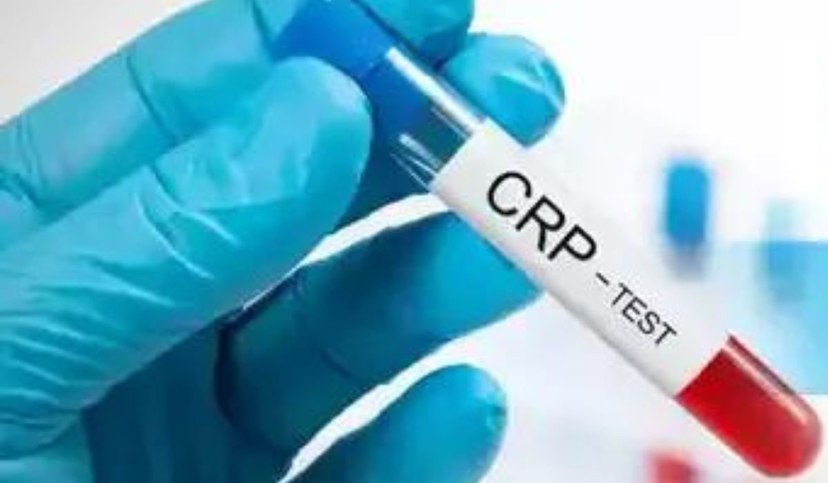 CRP Test Price in Bangladesh 2024
