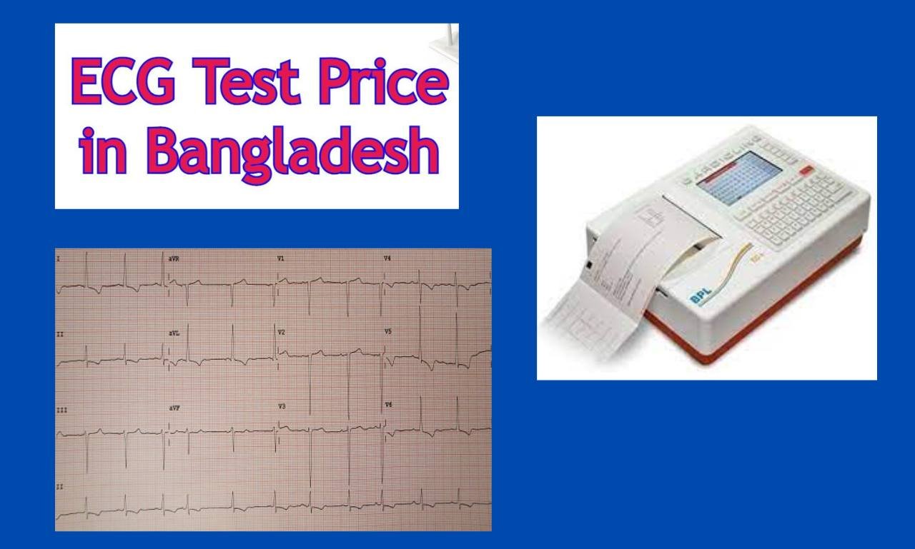 ECG-Test-Price-in-Bangladesh