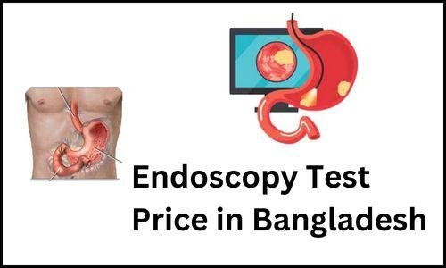 Endoscopy Test Price in Bangladesh: How Can I Get the Endoscopy Test Price in Bd?