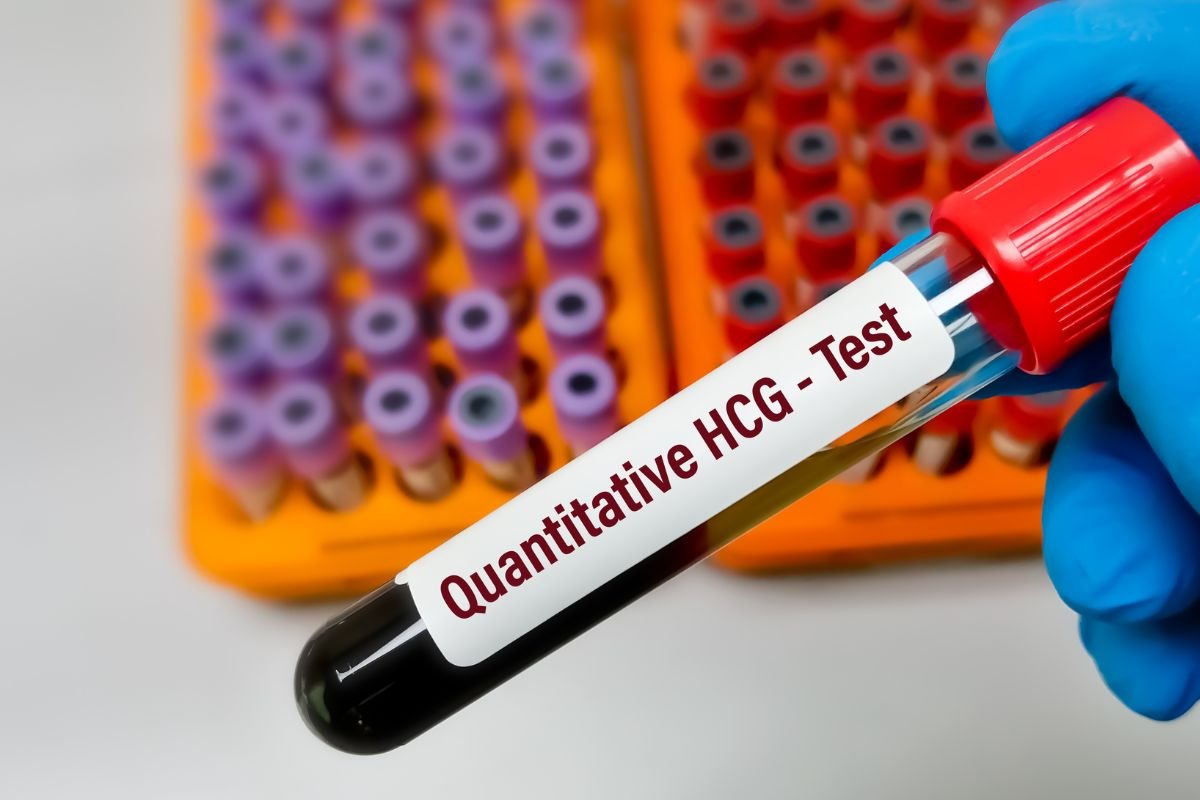HCG Test for Pregnancy: a Guideline
